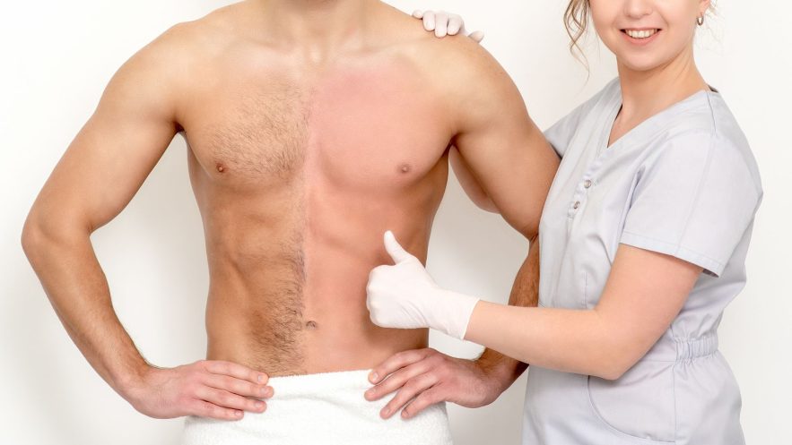 depilare petto uomo con macchinario laser diodo